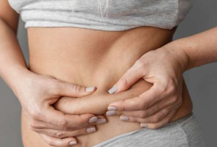 This Florida City Has Been Named as the Highest Obesity Rate in the State