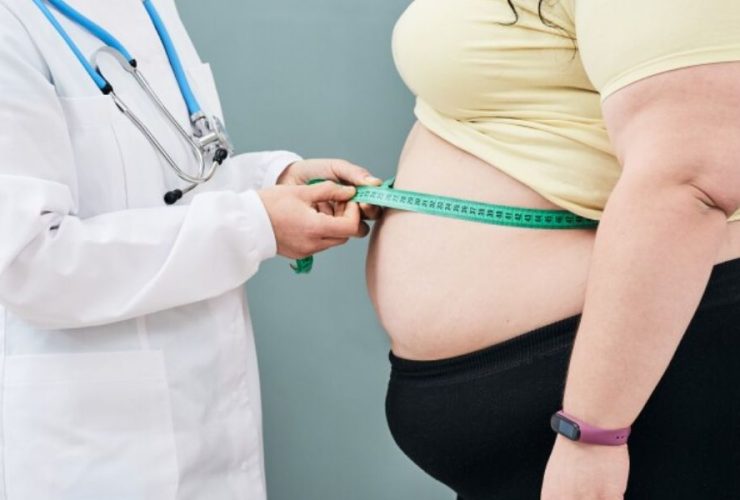 Obesity Epidemic Peaks in Arizona: Guess Which City Holds the Unsettling Record