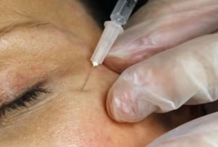 CDC Reports First Documented Cases of HIV Transmission via Cosmetic Needles