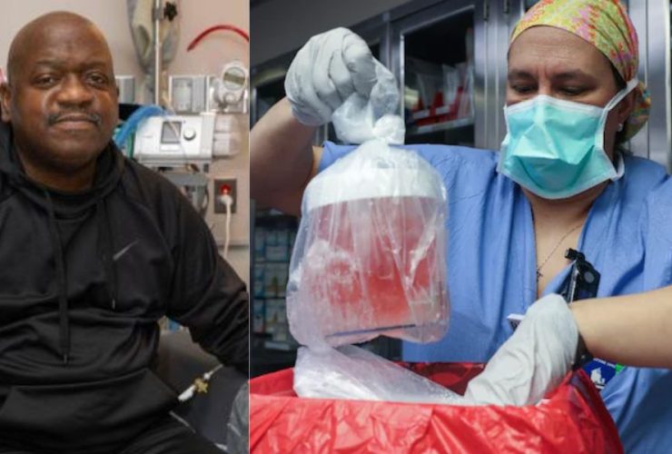 First-Ever Pig Kidney Transplant Recipient in Massachusetts Dies at 62