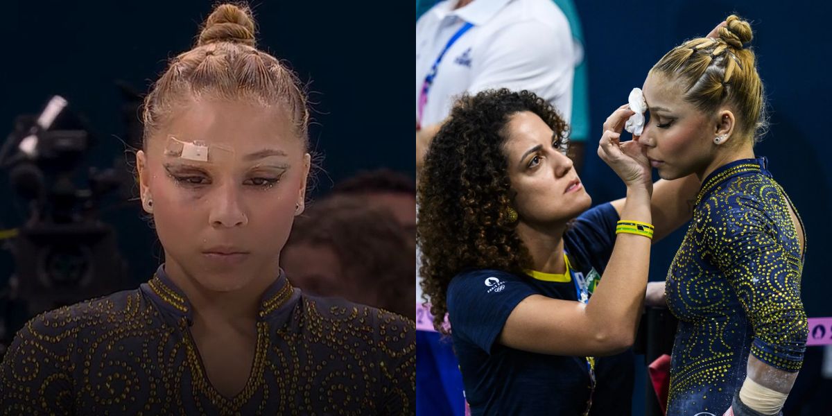 Flavia Saraiva’s Eyebrow Injury What Happened to the Brazilian Gymnast