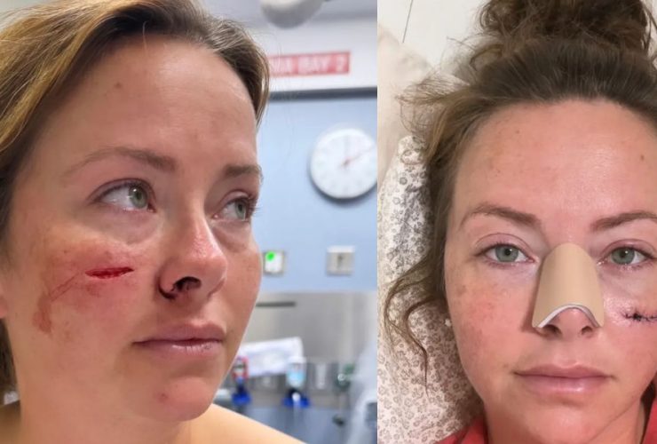 Tourist Stabbed by Homeless Repeat Offender at Newark Airport, Eight Days After Release