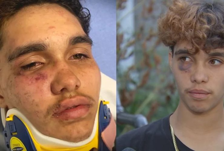 Violent Assault on 16-Year-Old Transgender Boy by Group of Teens in Massachusetts