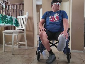Bacterial Infection from Foot Injury Leads to Nurse Losing Leg During Florida Getaway