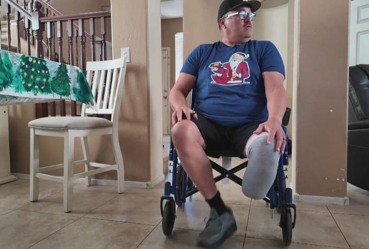 Bacterial Infection from Foot Injury Leads to Nurse Losing Leg During Florida Getaway